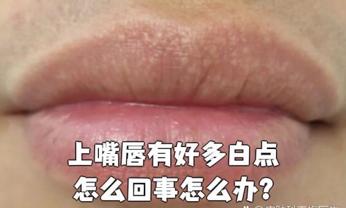 月经期间拉的大便带血-月经期间拉屎的地方出血怎么办网 :分享月经期间大便出来瞬间特别疼-月经期间拉血便是怎么回事知识